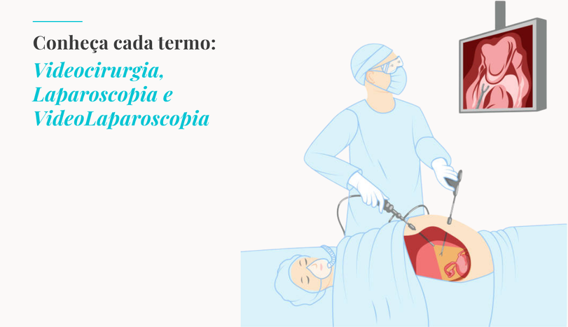 Qual a diferença entre Videocirurgia, Videolaparoscopia e Laparoscopia?